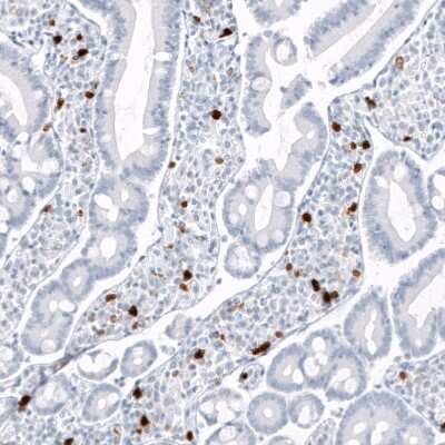 Immunohistochemistry-Paraffin: S100A9 Antibody (CL11191) [NBP3-07983] - Staining of human small intestine shows strong cytoplasmic positivity in lymphoid cells.