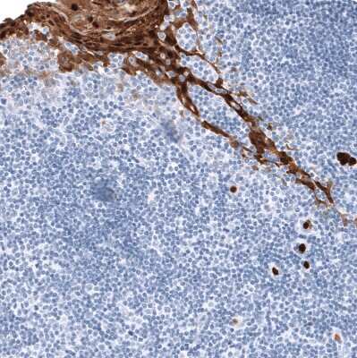 Immunohistochemistry-Paraffin: S100A9 Antibody (CL11191) [NBP3-07983] - Staining of human tonsil shows strong cytoplasmic positivity in squamous epithelial cells.