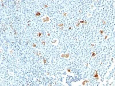 Immunohistochemistry-Paraffin: S100A9 Antibody (CPT/1028) [NBP2-44912] - Human Tonsil stained with Calprotectin Monoclonal Antibody (CPT/1028)