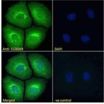 Immunocytochemistry/Immunofluorescence: S100A9 Antibody [NBP1-18843] - Immunofluorescence analysis of paraformaldehyde fixed MCF7 cells, permeabilized with 0.15% Triton. Primary incubation 1hr (10 ug/mL) followed by Alexa Fluor 488 secondary antibody (2 ug/mL), showing cytoplasmic and nuclear staining. The nuclear stain is DAPI (blue). Negative control: Unimmunized goat IgG (10 ug/mL) followed by Alexa Fluor 488 secondary antibody (2 ug/mL).