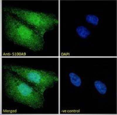 Immunocytochemistry/Immunofluorescence: S100A9 Antibody [NBP1-18843] - Immunofluorescence analysis of paraformaldehyde fixed U2OS cells, permeabilized with 0.15% Triton. Primary incubation 1hr (10 ug/mL) followed by Alexa Fluor 488 secondary antibody (2 ug/mL), showing nuclear and cytoplasmic staining. The nuclear stain is DAPI (blue). Negative control: Unimmunized goat IgG (10 ug/mL) followed by Alexa Fluor 488 secondary antibody (2 ug/mL).