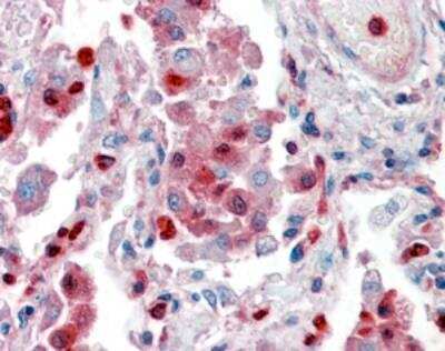 Immunohistochemistry-Paraffin: S100A9 Antibody [NBP1-18843] - Staining of paraffin embedded human lung. Antibody at 2.5 ug/mL. Steamed antigen retrieval with citrate buffer pH 6, AP-staining.