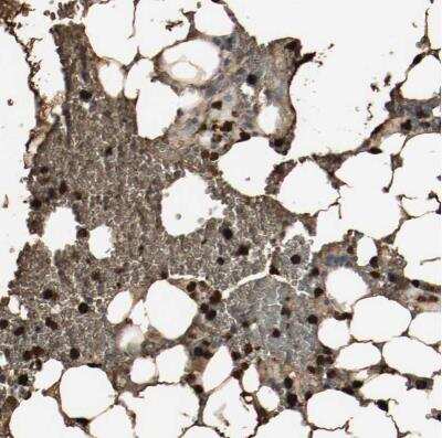 <b>Orthogonal Strategies Validation. </b>Immunohistochemistry-Paraffin: S100A9 Antibody [NBP1-89360] -  Staining of human bone marrow shows strong cytoplasmic positivity in a subset of hematopoietic cells.