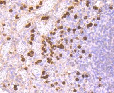 Immunohistochemistry-Paraffin: S100A9 Antibody (JF096-8) [NBP2-67124] - Analysis of paraffin-embedded human spleen tissue using anti-S100A9 antibody. Counter stained with hematoxylin.