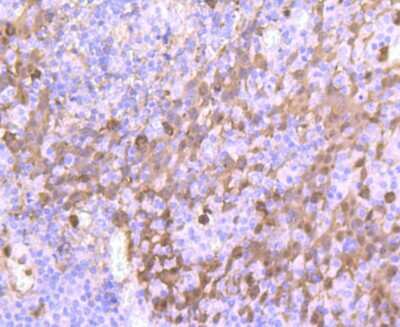 Immunohistochemistry-Paraffin: S100A9 Antibody (JF096-8) [NBP2-67124] - Analysis of paraffin-embedded human tonsil tissue using anti-S100A9 antibody. Counter stained with hematoxylin.