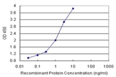 Sandwich ELISA: S100A9 Antibody Pair [H00006280-AP11] - Detection sensitivity ranging from 0.03 ng/ml to 100 ng/ml.