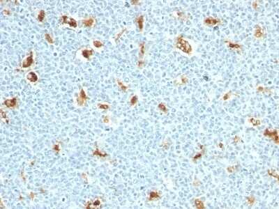 Immunohistochemistry-Paraffin: S100A9 Antibody (S100A9/1011) [NBP2-44910] - Human Tonsil stained with S100A9 Monoclonal Antibody (S100A9/1011)