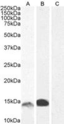Western Blot: S100A9 Antibody [NBP1-18843] - Staining of Human Bone Marrow (A) with antibody at 1 ug/mL and Gastrointestinal cancer (B) lysate with antibody at 0.5 ug/mL and negative control HepG2 (C) lysate. 5 ug protein in RIPA buffer. Detected by chemiluminescence.
