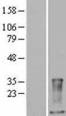 Western Blot S100A9 Overexpression Lysate