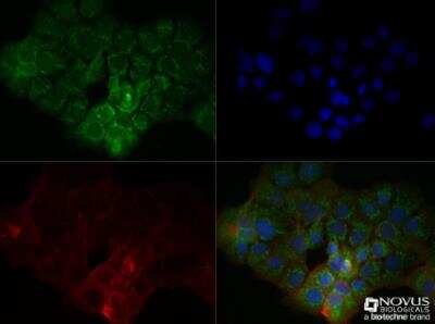 Immunocytochemistry/Immunofluorescence: S100B Antibody (15F9NB) - Azide Free [NBP2-45268] - Analysis in A431 cells were fixed for 10 minutes using 10% formalin and then permeabilized for 5 minutes using 1X TBS + 0.5% Triton X-100. The cells were incubated with S100B (15F4NB) at a 1:100 dilution overnight at 4 degrees Celsius and detected with DyLight 488 (Green) at a 1:500 dilution. Actin was detected with Phalloidin 568 (Red) at a 1:200 dilution. Nuclei were detected with DAPI (Blue) at 2.0 ug/ml in 1X PBS. Cells were imaged using a 40X objective.