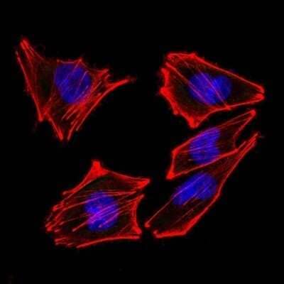 Immunocytochemistry/Immunofluorescence: S100B Antibody (4C4.9 + S100B/1012) [NBP2-54559] - analysis of A2058 cells using AF488-labeled Isotype Control Monoclonal Antibody (IgG2a) (Green). F-actin filaments were labeled with DyLight 554 Phalloidin (red). DAPI was used to stain the cell nuclei (blue). (Negative Control)