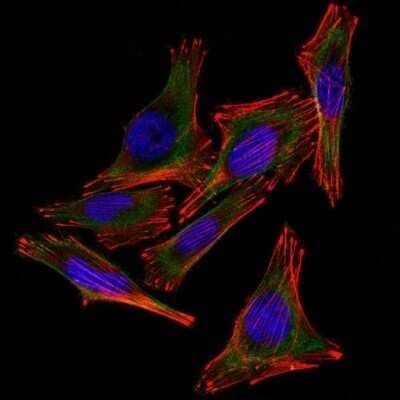 Immunocytochemistry/Immunofluorescence: S100B Antibody (4C4.9 + S100B/1012) [NBP2-54559] - analysis of A2058 cells using AF488-labeled S100B Monoclonal Antibody (4C4.9 + S100B/1012) (Green). F-actin filaments were labeled with DyLight 554 Phalloidin (red). DAPI was used to stain the cell nuclei (blue).