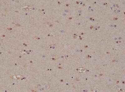 Immunohistochemistry-Paraffin: S100B Antibody (RM304) [NBP2-61585] - Immunohistochemical staining of formalin fixed and paraffin embedded human brain tissue section using NBP2-61585.