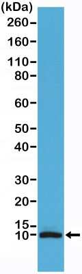 Western Blot: S100B Antibody (RM304) [NBP2-61585] - Western Blot of human brain tissue lysate using NBP2-61585.