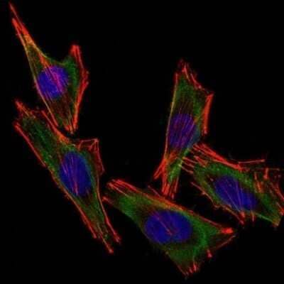 Immunocytochemistry/Immunofluorescence: S100B Antibody (S100B/1012) - Azide and BSA Free [NBP2-59619] - Confocal Immunofluorescent analysis of A2058 cells using AF488-labeled S100B Antibody (S100B/1012) (Green). F-actin filaments were labeled with DyLight 554 Phalloidin (red). DAPI was used to stain the cell nuclei (blue).