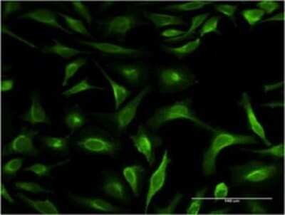 Immunocytochemistry/Immunofluorescence: S100P Antibody (1A11) [H00006286-M12] - Analysis of monoclonal antibody to S100P on HeLa cell. Antibody concentration 10 ug/ml