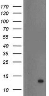 Western Blot: S100P Antibody (1A4) [NBP2-01900] - HEK293T cells were transfected with the pCMV6-ENTRY control (Left lane) or pCMV6-ENTRY S100P (Right lane) cDNA for 48 hrs and lysed. Equivalent amounts of cell lysates (5 ug per lane) were separated by SDS-PAGE and immunoblotted with anti-S100P.