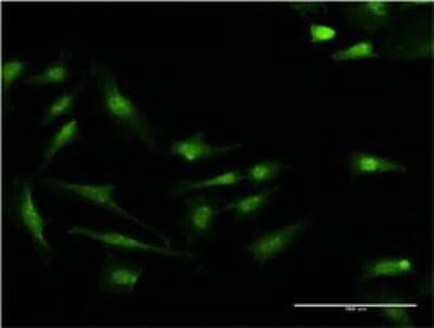Immunocytochemistry/Immunofluorescence: S100P Antibody (4E7) [H00006286-M02] - Analysis of monoclonal antibody to S100P on HeLa cell . Antibody concentration 10 ug/ml.