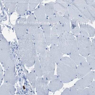 Immunohistochemistry-Paraffin: S100P Antibody [NBP1-89541] - Staining of human skeletal muscle shows low expression as expected.