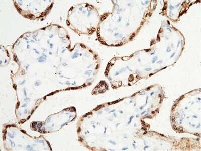 Immunohistochemistry-Paraffin: S100P Antibody [NBP3-00029] - Immunochemical staining of human S100P in human placenta with rabbit polyclonal antibody (1:1000, formalin-fixed paraffin embedded sections). The image showing nucleus staining of trophoblastic cells.