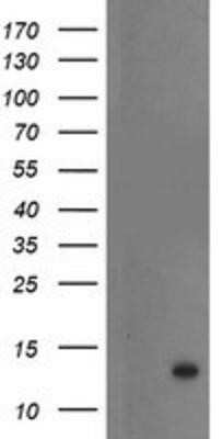 Western Blot: S100P Antibody (OTI1A4) - Azide and BSA Free [NBP2-73972] - HEK293T cells were transfected with the pCMV6-ENTRY control (Left lane) or pCMV6-ENTRY S100P (Right lane) cDNA for 48 hrs and lysed. Equivalent amounts of cell lysates (5 ug per lane) were separated by SDS-PAGE and immunoblotted with anti-S100P.