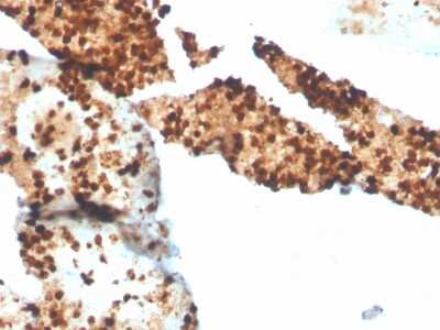 Immunohistochemistry-Paraffin: S100P Antibody (S100P/4386R) [NBP3-07746] - Formalin-fixed, paraffin-embedded human spleen stained with S100P Recombinant Rabbit Monoclonal Antibody (S100P/4386R).
