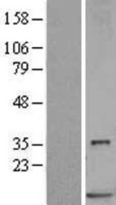 Western Blot: S100P Overexpression Lysate (Adult Normal) [NBL1-15663] Left-Empty vector transfected control cell lysate (HEK293 cell lysate); Right -Over-expression Lysate for S100P.