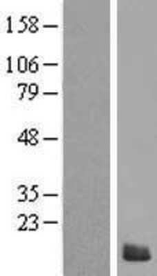 Western Blot: S100Z Overexpression Lysate (Adult Normal) [NBP2-05733] Left-Empty vector transfected control cell lysate (HEK293 cell lysate); Right -Over-expression Lysate for S100Z.