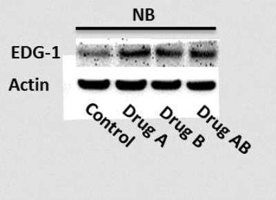Western Blot: S1P1/EDG-1 Antibody [NBP2-24622] -  EDG1 levels in human neuroblastoma with various drugs and control. Image from verified customer review.