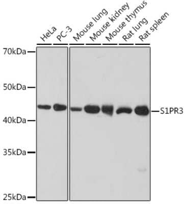 Western Blot: S1P3/EDG-3 Antibody (5E3G9) [NBP3-15479] - Western blot analysis of extracts of various cell lines, using S1P3/EDG-3 Rabbit mAb (NBP3-15479) at 1:1000 dilution. Secondary antibody: HRP Goat Anti-Rabbit IgG (H+L) at 1:10000 dilution. Lysates/proteins: 25ug per lane. Blocking buffer: 3% nonfat dry milk in TBST. Detection: ECL Basic Kit. Exposure time: 10s.