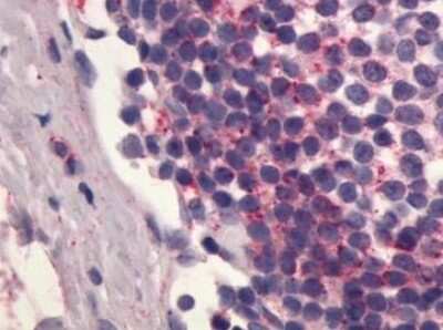 Immunohistochemistry: S1P4/EDG-6 Antibody [NLS70] - Analysis of anti-S1PR4 / EDG6 antibody with human lymph node.