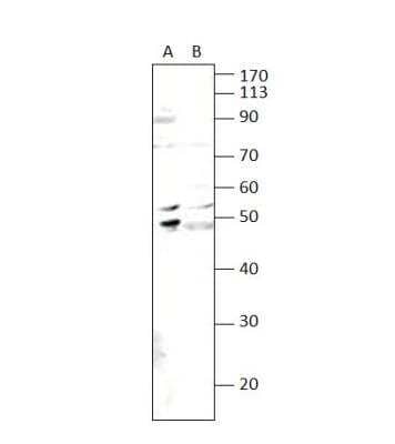 Western Blot: S1P5/EDG-8 Antibody [NBP3-12308] - (A) AND T47D cells (B). 1:500 antibody dilution in DiluObuffer. Apparent MW is 49 KDa.