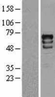 Western Blot p70 S6 Kinase/S6K Overexpression Lysate