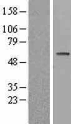 Western Blot: S6K2 Overexpression Lysate (Adult Normal) [NBL1-15575] Left-Empty vector transfected control cell lysate (HEK293 cell lysate); Right -Over-expression Lysate for S6K2.