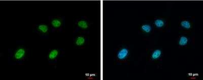 <b>Genetic Strategies Validation. </b>Immunocytochemistry/Immunofluorescence: SA1 Antibody (1515) [NBP2-43751] - Analysis of Sample: HeLa cells were fixed in 4% paraformaldehyde at RT for 15 min. Green: STAG1 protein stained by STAG1 antibody [1515] diluted at 1:1000. Blue: Hoechst 33342 staining.