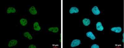 <b>Genetic Strategies Validation. </b>Immunocytochemistry/Immunofluorescence: SA1 Antibody (8810) [NBP2-43750] - Analysis of Sample: HeLa cells were fixed in 4% paraformaldehyde at RT for 15 min. Green: STAG1 protein stained by STAG1 antibody [8810] diluted at 1:1000. Blue: Hoechst 33342 staining. Scale bar = 10 um.