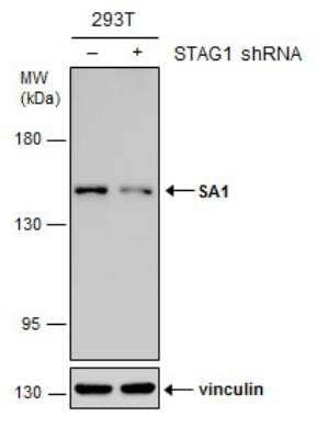 Western Blot: SA1 Antibody (8810) [NBP2-43750] - Non-transfected (-) and transfected (+) 293T whole cell extracts (30 ug) were separated by 5% SDS-PAGE, and the membrane was blotted with SA1 antibody [8810].