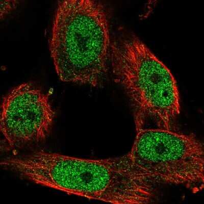 Immunocytochemistry/Immunofluorescence: SA1 Antibody [NBP2-54976] - Staining of human cell line U-251 MG shows localization to nucleoplasm.