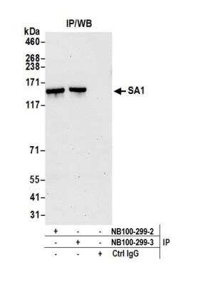 Immunoprecipitation: SA1 Antibody [NB100-299] - Detection of human SA1 by western blot of immunoprecipitates. Samples: Whole cell lysate (1.0 mg per IP reaction; 20% of IP loaded) from HeLa cells prepared using NETN lysis buffer. Antibodies: Affinity purified goat anti-SA1 antibody NB100-299 (lot NB100-299-3) used for IP at 6 ug per reaction. SA1 was also immunoprecipitated by a previous lot of this antibody (lot NB100-299-2). For blotting immunoprecipitated SA1, NB100-299 was used at 0.1 ug/ml. Detection: Chemiluminescence with an exposure time of 30 seconds.