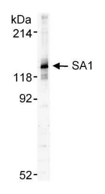 Western Blot: SA1 Antibody [NB100-298] - Nuclear extract from approx. 500,000 HeLa cells.  Antibody used at 0.5 ug/ml.