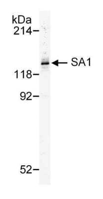 Western Blot: SA1 Antibody [NB100-299] - Nuclear extract from approx. 500,000 HeLa cells. Antibody used at 0.5 ug/ml.