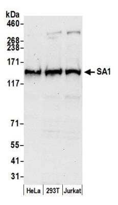 Western Blot: SA1 Antibody [NB100-299] - Detection of human SA1 by western blot. Samples: Whole cell lysate (50 ug) from HeLa, 293T, and Jurkat cells prepared using NETN lysis buffer. Antibody: Affinity purified goat anti-SA1 antibody NB100-299 used for WB at 0.1 ug/ml. Detection: Chemiluminescence with an exposure time of 30 seconds.