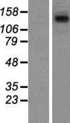 Western Blot: SA1 Overexpression Lysate (Adult Normal) [NBP2-10440] Left-Empty vector transfected control cell lysate (HEK293 cell lysate); Right -Over-expression Lysate for SA1.