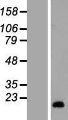 Western Blot: SAA2 Overexpression Lysate (Adult Normal) [NBL1-15672] Left-Empty vector transfected control cell lysate (HEK293 cell lysate); Right -Over-expression Lysate for SAA2.