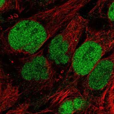 <b>Independent Antibodies Validation. </b>Immunocytochemistry/Immunofluorescence: SAAL1 Antibody [NBP2-58797] - Staining of human cell line CACO-2 shows localization to nucleoplasm. Antibody staining is shown in green.