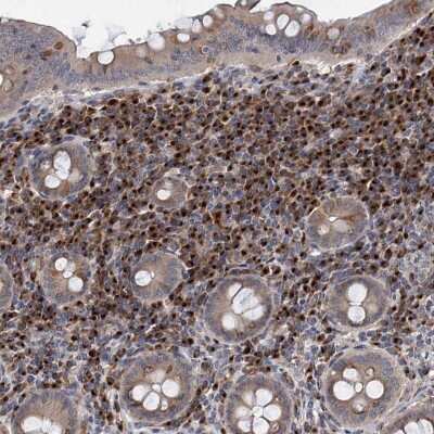 <b>Independent Antibodies Validation. </b>Immunohistochemistry-Paraffin: SAAL1 Antibody [NBP1-83447] - Staining of human appendix shows cytoplasmic positivity in lymphoid tissue.