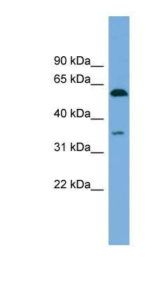 Western Blot: SAAL1 Antibody [NBP1-57062] - MCF-7 whole cell lysates, concentration 0.2-1 ug/ml.
