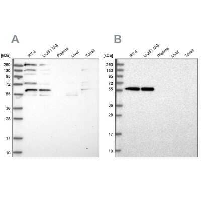 Western Blot: SAAL1 Antibody [NBP1-83447] - Analysis using Anti-SAAL1 antibody NBP1-83447 (A) shows similar pattern to independent antibody NBP2-58797 (B).