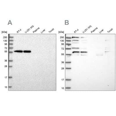 Western Blot: SAAL1 Antibody [NBP2-58797] - Analysis using Anti-SAAL1 antibody NBP2-58797 (A) shows similar pattern to independent antibody NBP1-83447 (B).
