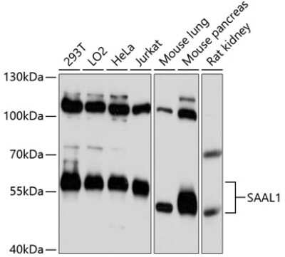Western Blot: SAAL1 Antibody [NBP2-93623] - Analysis of extracts of various cell lines, using SAAL1 . Exposure time: 10s.